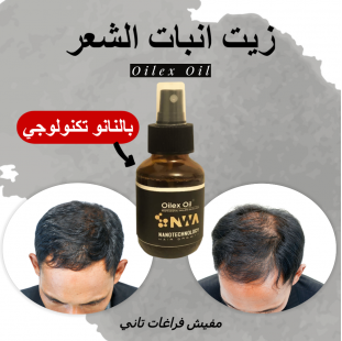 زيت لانبات الشعر والحمايه من الصلع بخصيه النانو تكنولوجي